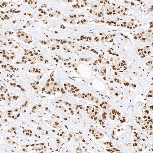 XPO1/CRM1 Recombinant Rabbit mAb (S-3309-7)