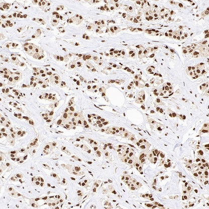 XPO1/CRM1 Recombinant Rabbit mAb (S-3309-7)