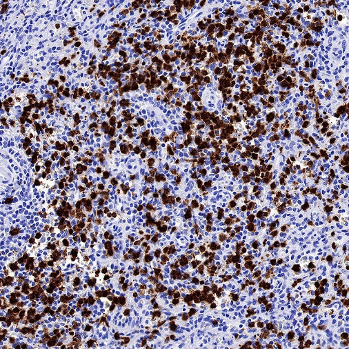 c-IAP1 Recombinant Rabbit mAb (S-1128-137)