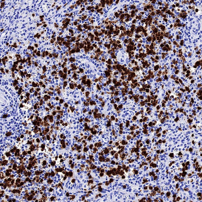 c-IAP1 Recombinant Rabbit mAb (S-1128-137)