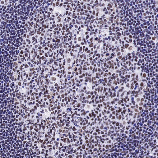 U2AF2 Recombinant Rabbit mAb (S-1324-1)