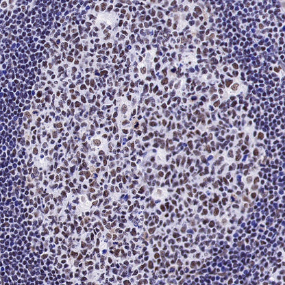 U2AF2 Recombinant Rabbit mAb (S-1324-1)