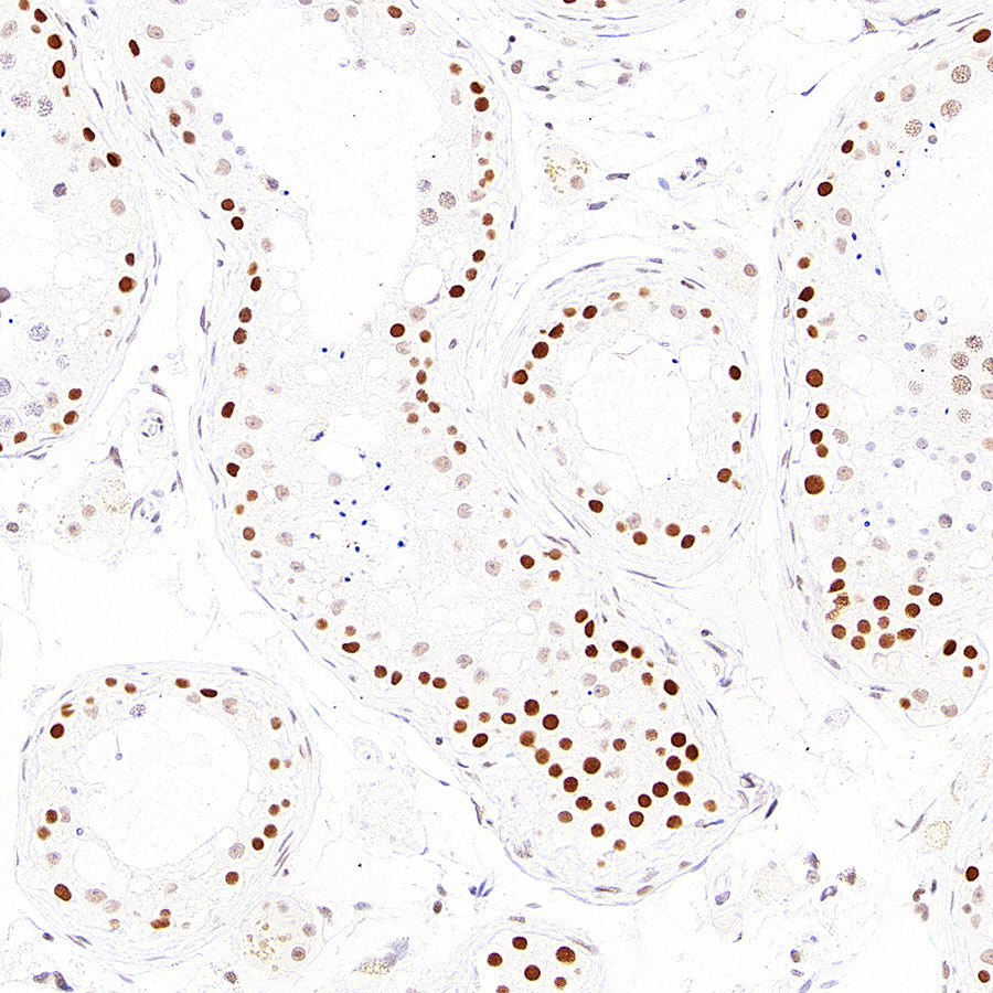 RAD21 Recombinant Rabbit mAb (S-4271-136)