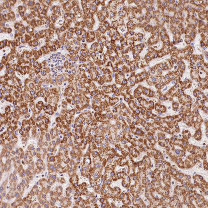 UQCRC2 Recombinant Rabbit mAb (S-2374-127)