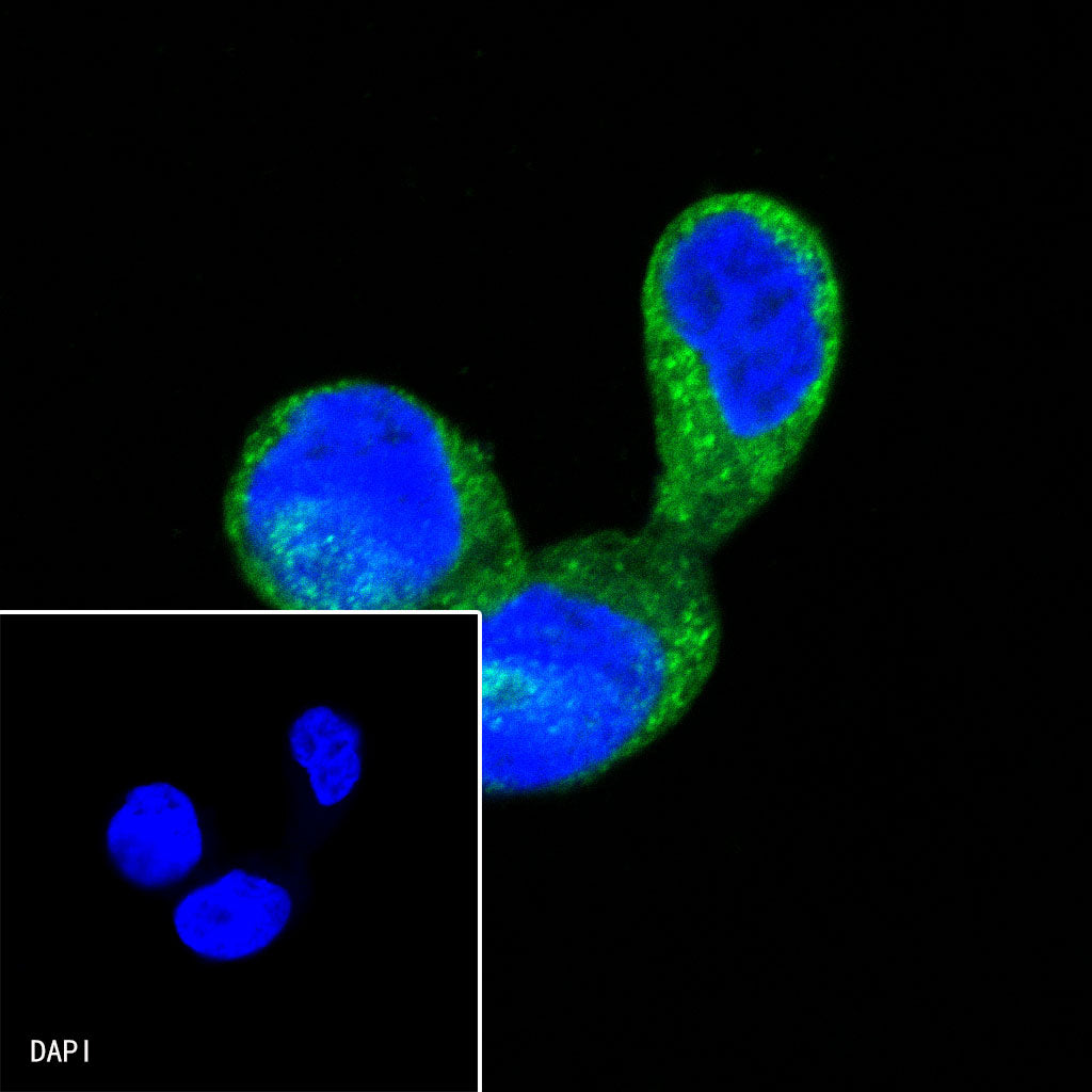 AMACR/p504s Recombinant Rabbit mAb (SDT-401-29)