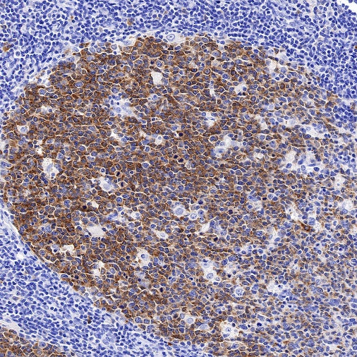 AICDA Recombinant Rabbit mAb (S-1030-15)