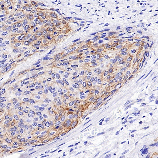 UBASH3B/Sts1 Recombinant Rabbit mAb (S-1307-5)