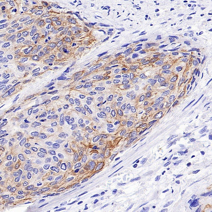 UBASH3B/Sts1 Recombinant Rabbit mAb (S-1307-5)