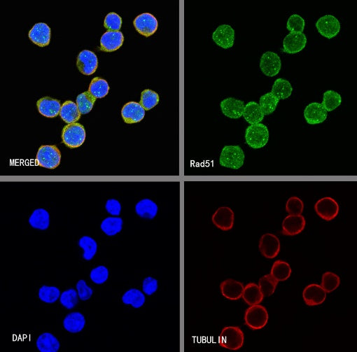 Rad51 Recombinant Rabbit mAb (S-R347)