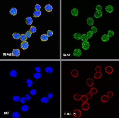 Rad51 Recombinant Rabbit mAb (S-R347)