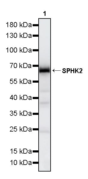 SPHK2 Recombinant Rabbit mAb (S-5307)
