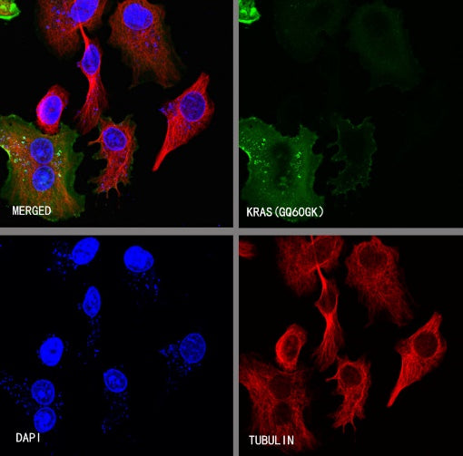 KRAS (mutated GQ60GK) + (mutated Q61K) Recombinant Rabbit mAb (S-604-4)