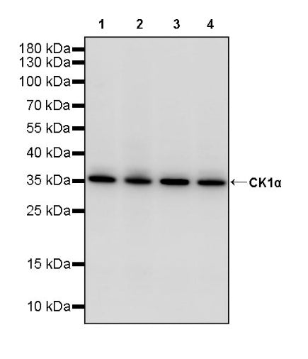 CK1α Recombinant Rabbit mAb ,PBS Only(SDT-2884-60)