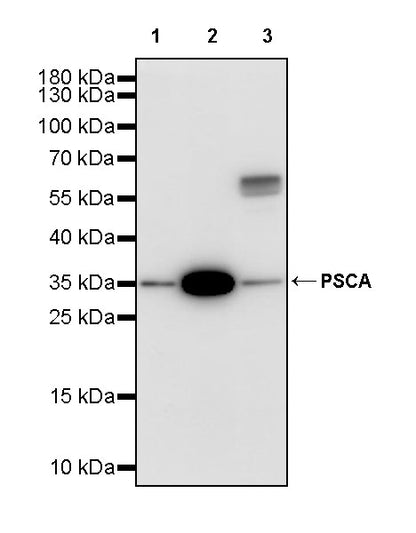 PSCA Recombinant Rabbit mAb (S-3475-72)