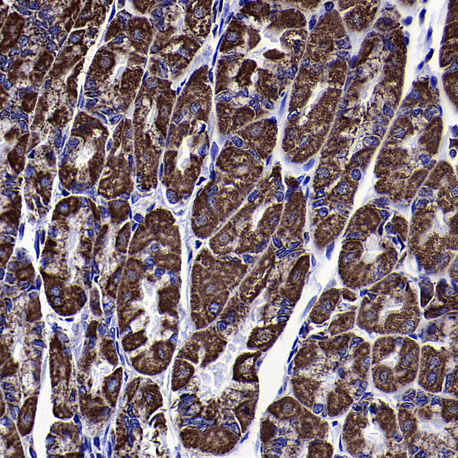 VDAC1 Recombinant Rabbit mAb (S-5314)