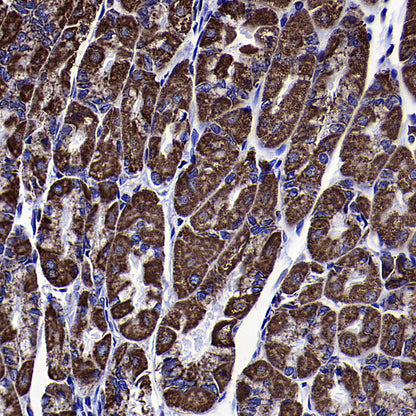VDAC1 Recombinant Rabbit mAb (S-5314)