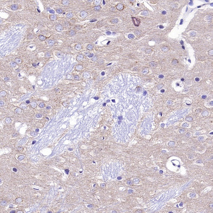 SCAMP1 Rabbit Polyclonal Antibody