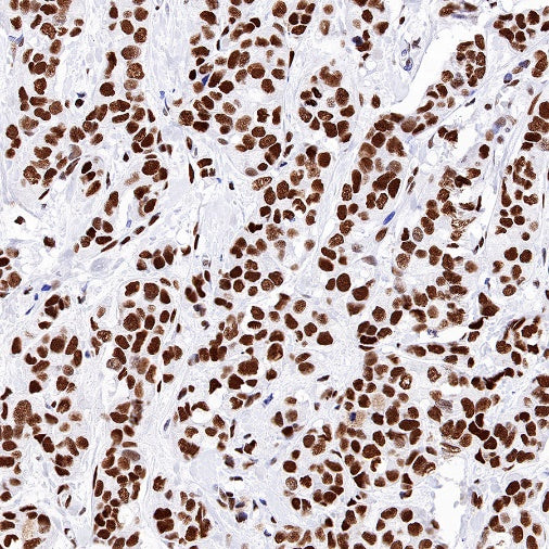 KAP-1 Recombinant Rabbit mAb (S-986-5)
