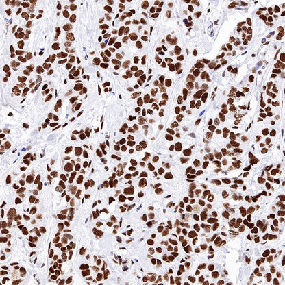 KAP-1 Recombinant Rabbit mAb (S-986-5)