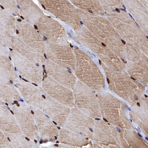Parvalbumin Recombinant Rabbit mAb (S-1620-10)