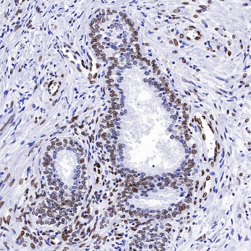 Lamin A Recombinant Rabbit mAb (S-1503-44)