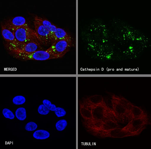 Cathepsin D Recombinant Rabbit mAb (S-R345)