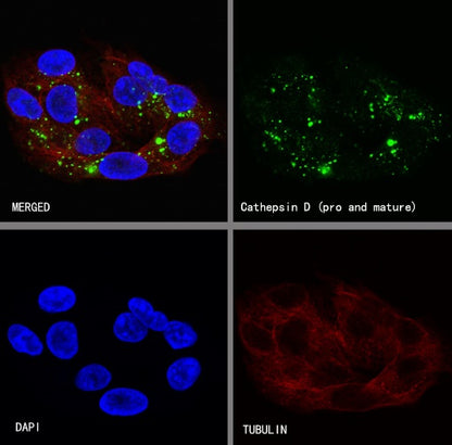 Cathepsin D Recombinant Rabbit mAb (S-R345)