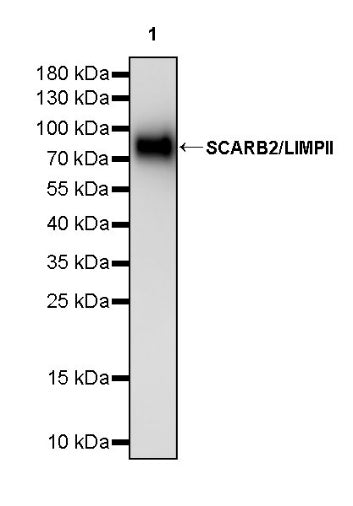 SCARB2/LIMPII Recombinant Rabbit mAb (S-2847-21)