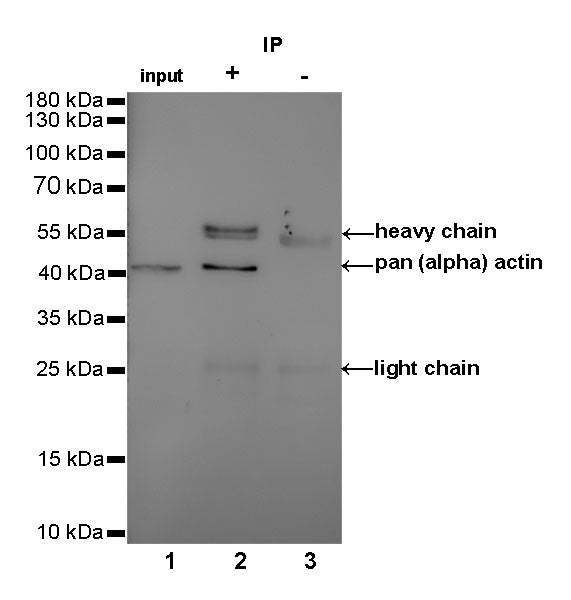 pan (alpha) actin Recombinant Rabbit mAb (SDT-044-17)