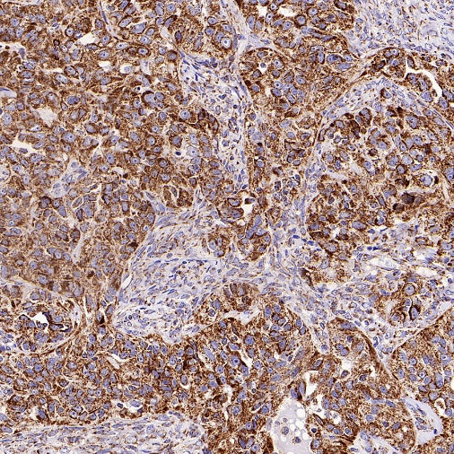 UQCRC2 Recombinant Rabbit mAb (S-2374-127)