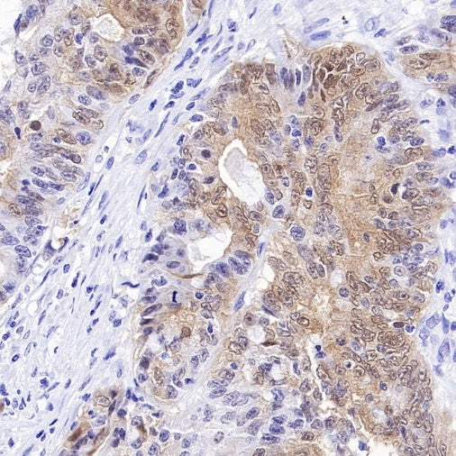 CDKN2A/p16 INK4A Recombinant Rabbit mAb (S-4676)