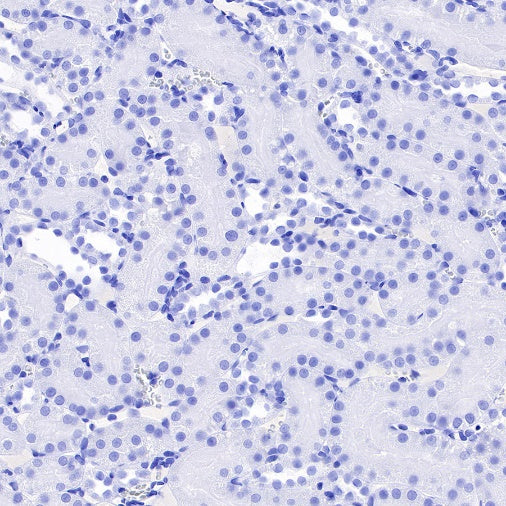 Myelin Basic Protein Recombinant Rabbit mAb (S-582-79)