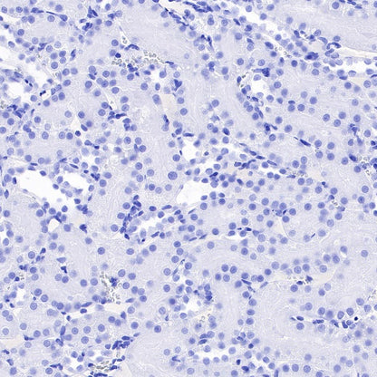 Myelin Basic Protein Recombinant Rabbit mAb (S-582-79)
