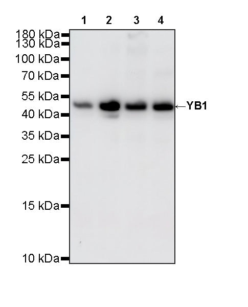 YB1 Recombinant Rabbit mAb (S-6245)