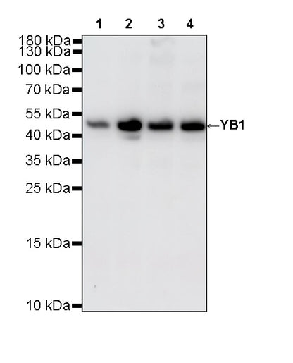 YB1 Recombinant Rabbit mAb (S-6245)
