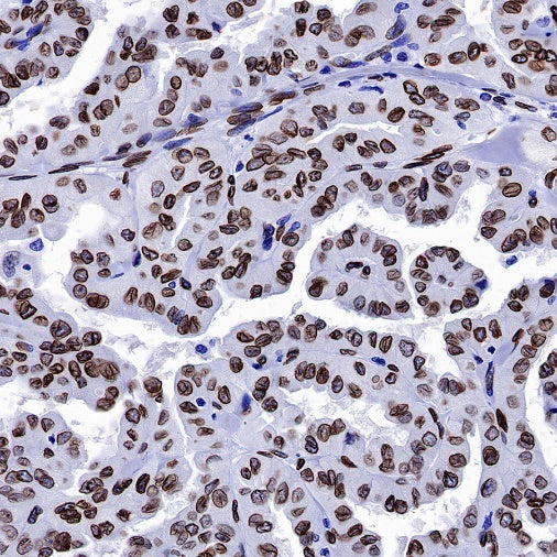 Lamin A Recombinant Rabbit mAb (S-1503-44)