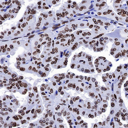Lamin A Recombinant Rabbit mAb (S-1503-44)