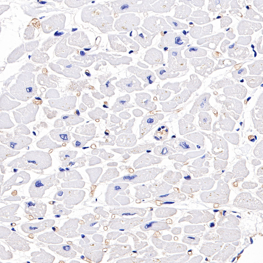 Hemoglobin Recombinant Rabbit mAb (SDT-193-71)