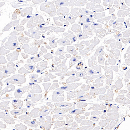 Hemoglobin Recombinant Rabbit mAb (SDT-193-71)