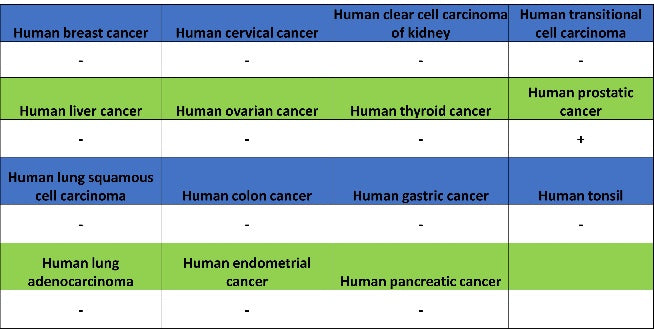 NKX3.1 Recombinant Rabbit mAb (S-2778-63)