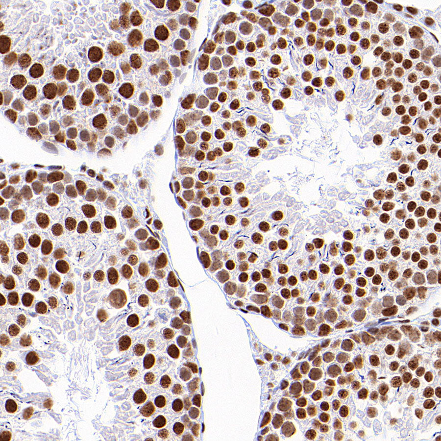 SF3B1 Rabbit Polyclonal Antibody