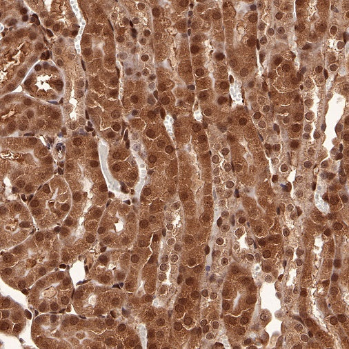 SBDS Recombinant Rabbit mAb (S-R344)