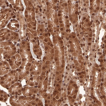 SBDS Recombinant Rabbit mAb (S-R344)