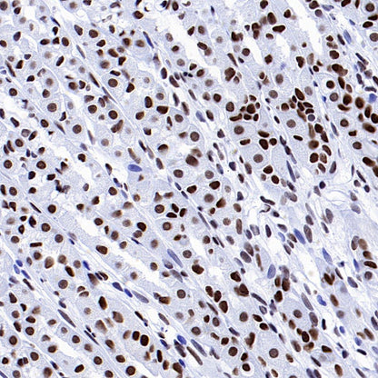 RIBEYE/CTBP2 Rabbit Polyclonal Antibody
