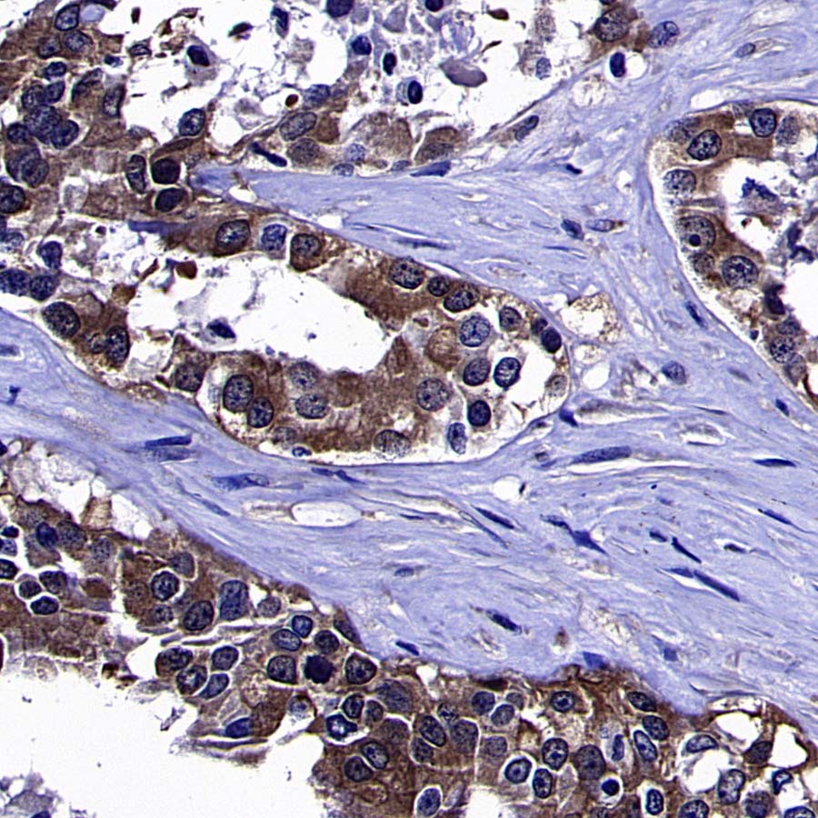 AKT1S1/PRAS40 Recombinant Rabbit mAb (S-4240-49)
