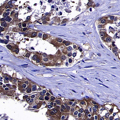AKT1S1/PRAS40 Recombinant Rabbit mAb (S-4240-49)