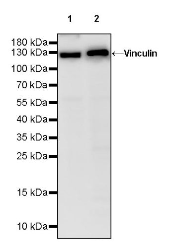 Vinculin Recombinant Rabbit mAb (S-1635-3)