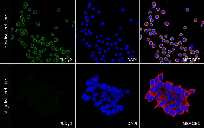 PLCγ2 Recombinant Rabbit mAb (S-2749-14)