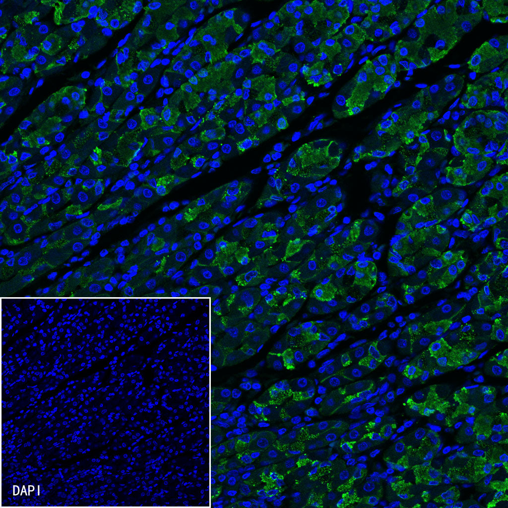 Claudin18.2 Recombinant Rabbit mAb,PBS Only (SDT-102-24)