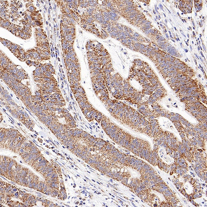 Thioredoxin/TRX Recombinant Rabbit mAb (S-1862-26)
